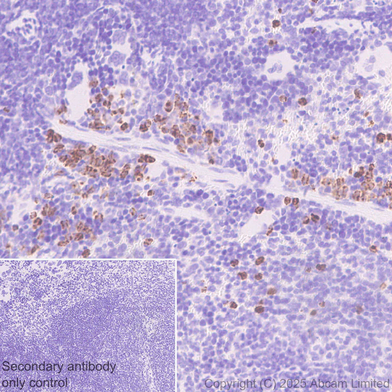 Immunohistochemistry (Formalin/PFA-fixed paraffin-embedded sections) - Anti-PGRPS antibody [EPR30470-91] (AB325131)
