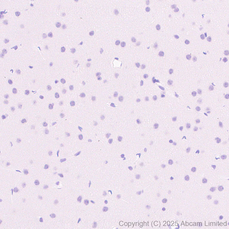 Immunohistochemistry (Formalin/PFA-fixed paraffin-embedded sections) - Anti-PGRPS antibody [EPR30470-91] (AB325131)