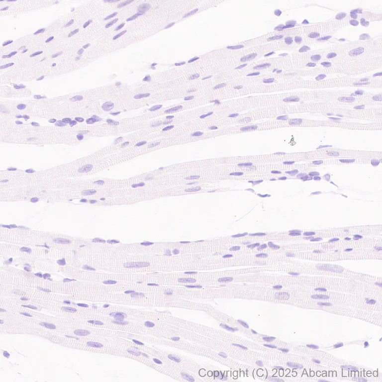 Immunohistochemistry (Formalin/PFA-fixed paraffin-embedded sections) - Anti-PGRPS antibody [EPR30470-91] (AB325131)