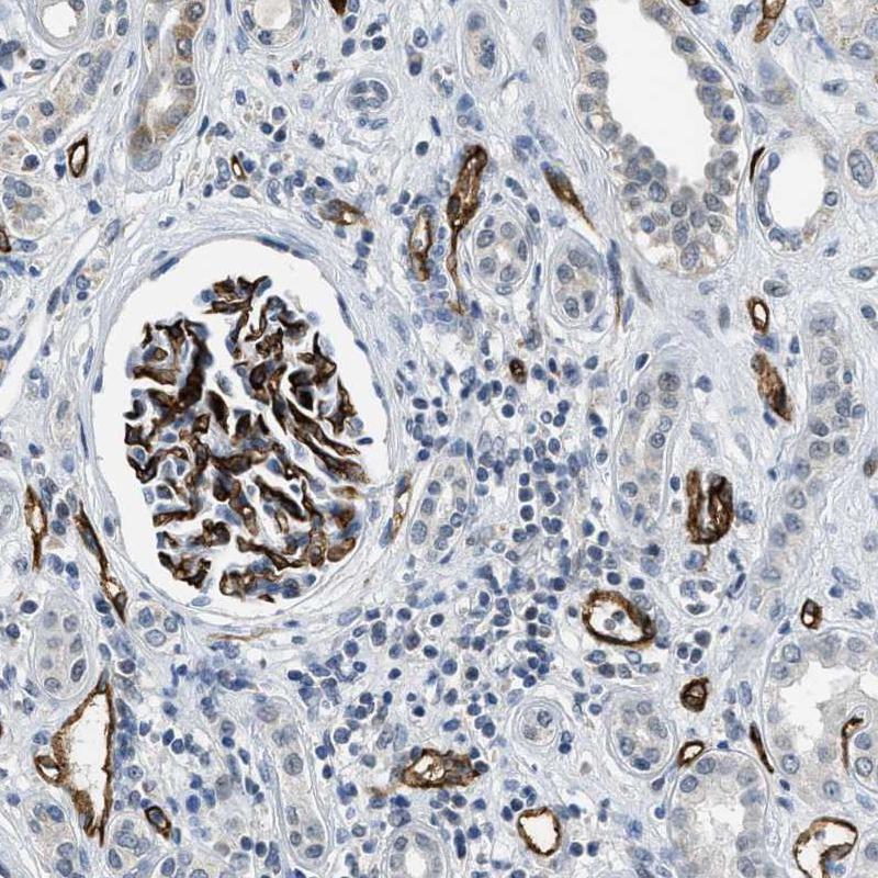 Immunohistochemistry (Formalin/PFA-fixed paraffin-embedded sections) - Anti-PGT antibody (AB150788), expandable thumbnail
