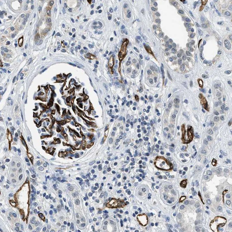 Immunohistochemistry (Formalin/PFA-fixed paraffin-embedded sections) - Anti-PGT antibody (AB150788)