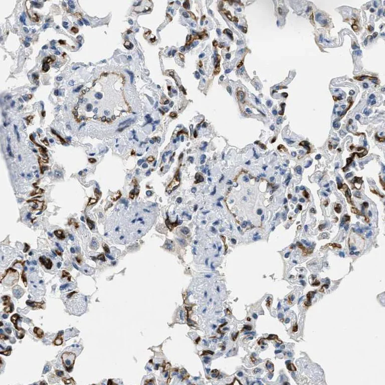 Immunohistochemistry (Formalin/PFA-fixed paraffin-embedded sections) - Anti-PGT antibody (AB150788)
