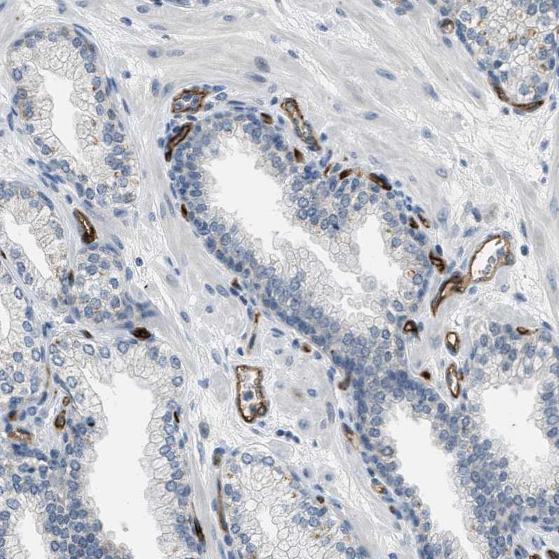 Immunohistochemistry (Formalin/PFA-fixed paraffin-embedded sections) - Anti-PGT antibody (AB150788), expandable thumbnail