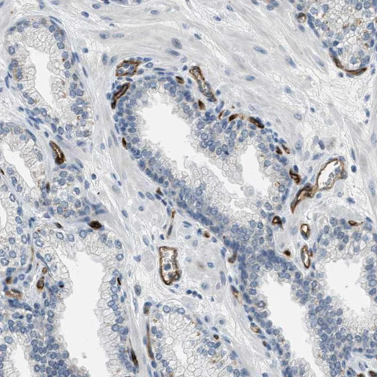 Immunohistochemistry (Formalin/PFA-fixed paraffin-embedded sections) - Anti-PGT antibody (AB150788)