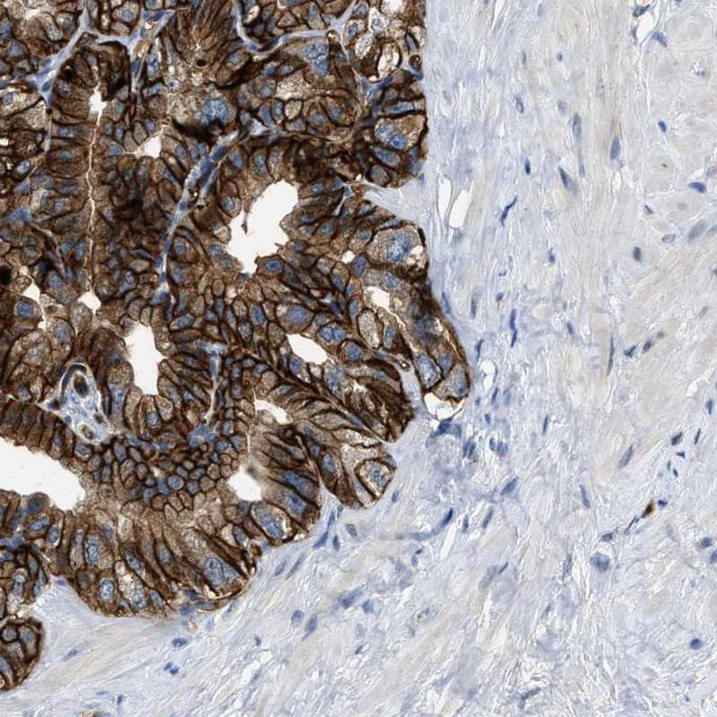 Immunohistochemistry (Formalin/PFA-fixed paraffin-embedded sections) - Anti-PGT antibody (AB150788), expandable thumbnail