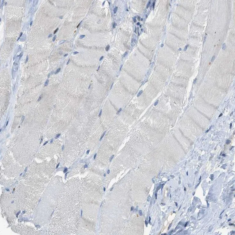 Immunohistochemistry (Formalin/PFA-fixed paraffin-embedded sections) - Anti-PGT antibody (AB150788)