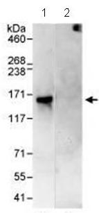 Immunoprecipitation - Anti-PH3 antibody (AB80612)