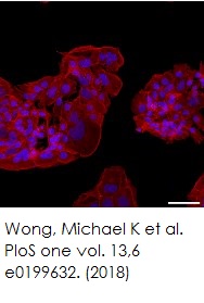 Functional Studies - Phalloidin-iFluor 555 Reagent (AB176756), expandable thumbnail