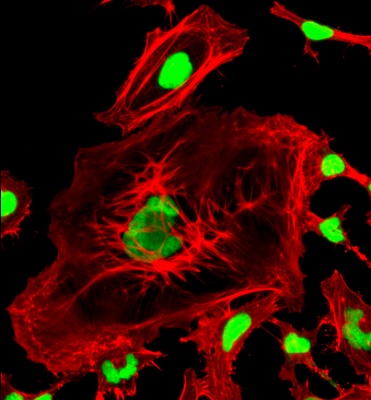 Immunocytochemistry/ Immunofluorescence - Phalloidin-iFluor 555 Reagent (AB176756), expandable thumbnail