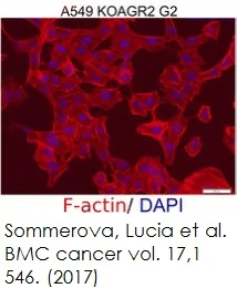 Functional Studies - Phalloidin-iFluor 594 Reagent (AB176757)