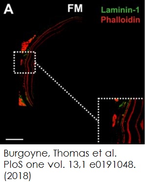 Functional Studies - Phalloidin-iFluor 647 Reagent (AB176759), expandable thumbnail