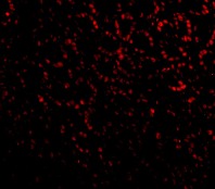 Immunocytochemistry/ Immunofluorescence - Anti-PHAP1 antibody (AB5991)