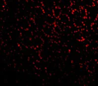 Immunocytochemistry/ Immunofluorescence - Anti-PHAP1 antibody (AB5991)