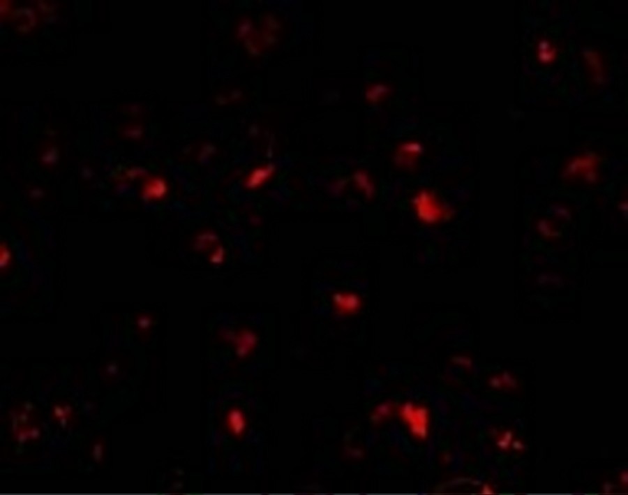 Immunocytochemistry/ Immunofluorescence - Anti-PHAP1 antibody (AB5992), expandable thumbnail