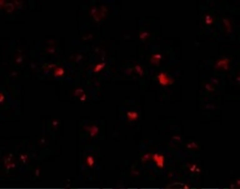 Immunocytochemistry/ Immunofluorescence - Anti-PHAP1 antibody (AB5992)