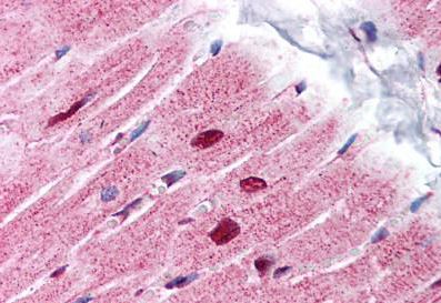 Immunohistochemistry (Formalin/PFA-fixed paraffin-embedded sections) - Anti-PHAP1 antibody - C-terminal (AB189110)