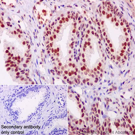 Immunohistochemistry (Formalin/PFA-fixed paraffin-embedded sections) - Anti-PHAPI2 / APRIL antibody [EPR14588] (AB200836)