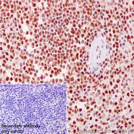 Immunohistochemistry (Formalin/PFA-fixed paraffin-embedded sections) - Anti-PHAPI2 / APRIL antibody [EPR14588] - BSA and Azide free (AB239014)