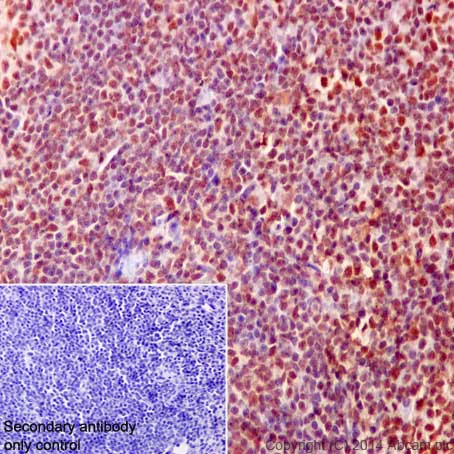 Immunohistochemistry (Formalin/PFA-fixed paraffin-embedded sections) - Anti-PHAPI2 / APRIL antibody [EPR14588] - BSA and Azide free (AB239014)