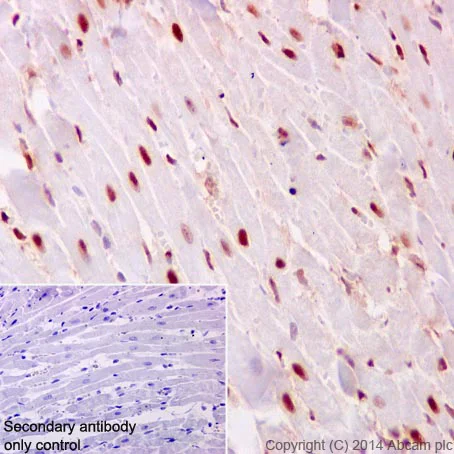 Immunohistochemistry (Formalin/PFA-fixed paraffin-embedded sections) - Anti-PHAPI2 / APRIL antibody [EPR14588] - BSA and Azide free (AB239014)
