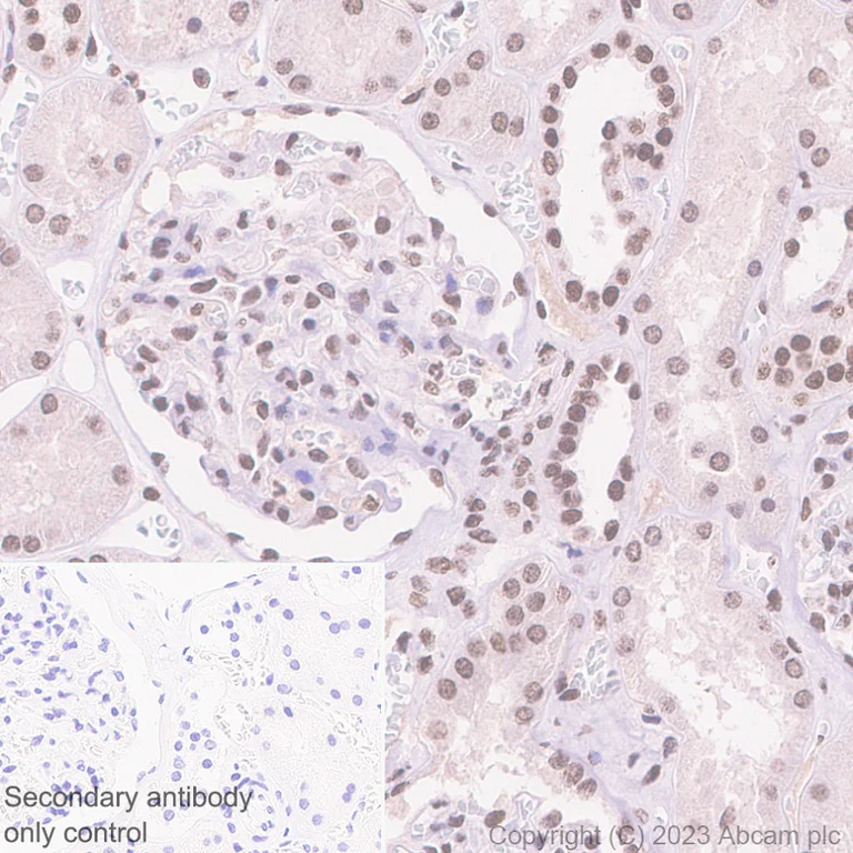 Immunohistochemistry (Formalin/PFA-fixed paraffin-embedded sections) - Anti-PHC2 antibody [EPR27147-176] - ChIP Grade (AB314436)