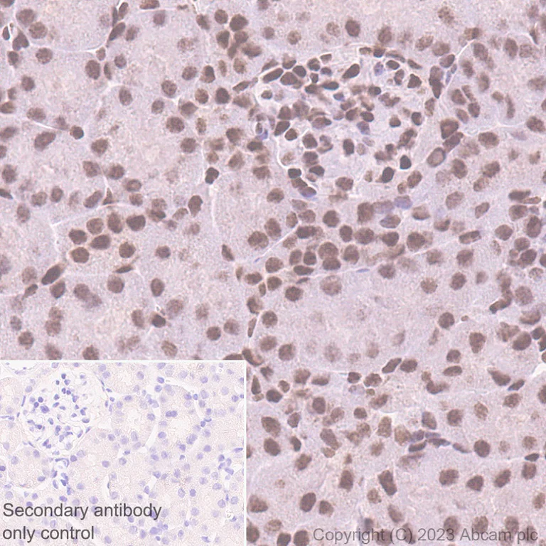 Immunohistochemistry (Formalin/PFA-fixed paraffin-embedded sections) - Anti-PHC2 antibody [EPR27147-176] - ChIP Grade (AB314436)
