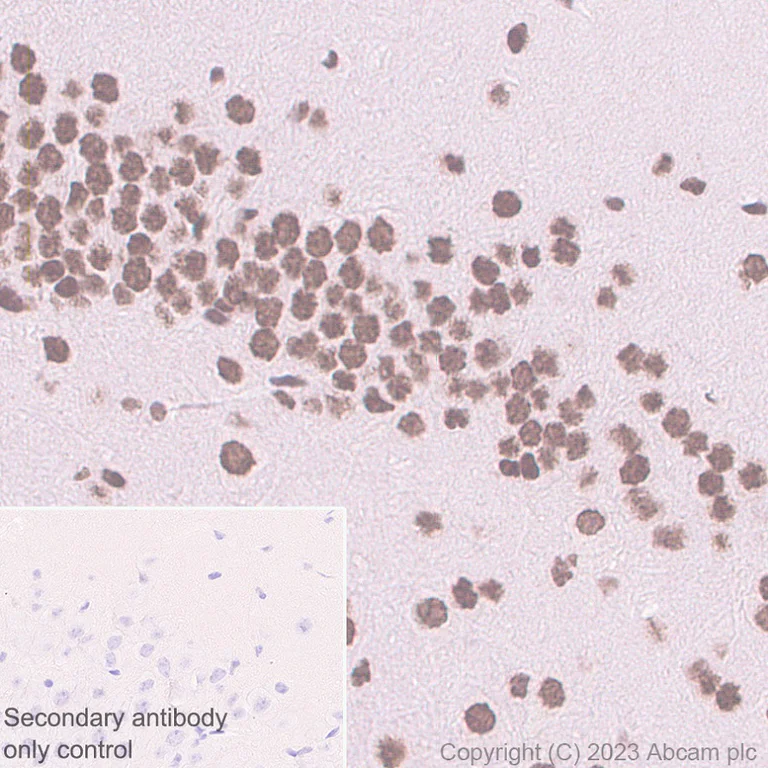 Immunohistochemistry (Formalin/PFA-fixed paraffin-embedded sections) - Anti-PHC2 antibody [EPR27147-176] - ChIP Grade (AB314436)