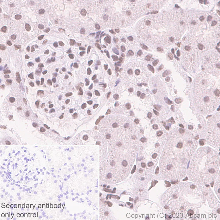 Immunohistochemistry (Formalin/PFA-fixed paraffin-embedded sections) - Anti-PHC2 antibody [EPR27147-176] - ChIP Grade (AB314436)