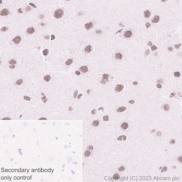 Immunohistochemistry (Formalin/PFA-fixed paraffin-embedded sections) - Anti-PHC2 antibody [EPR27147-176] - ChIP Grade (AB314436)