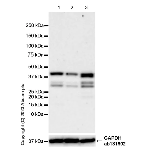 Western blot - Anti-PHC2 antibody [EPR27147-176] - ChIP Grade (AB314436)