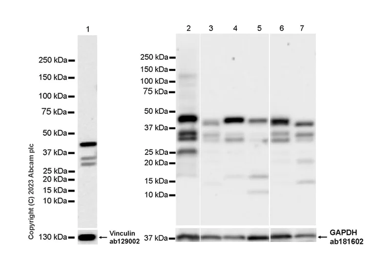 Western blot - Anti-PHC2 antibody [EPR27147-176] - ChIP Grade (AB314436)
