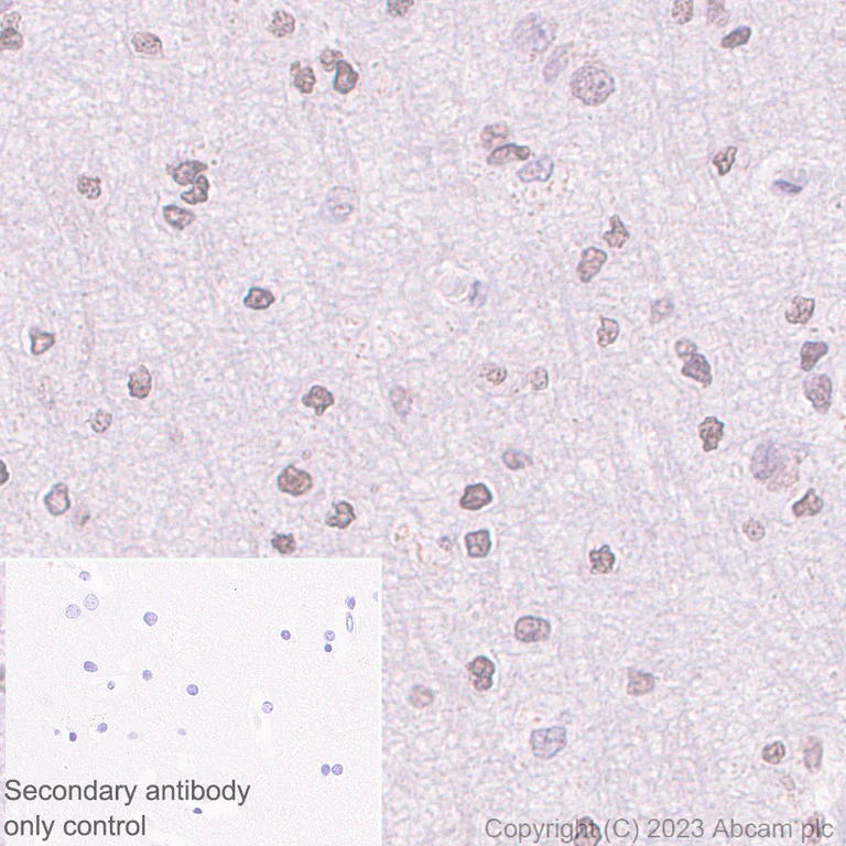 Immunohistochemistry (Formalin/PFA-fixed paraffin-embedded sections) - Anti-PHC2 antibody [EPR27147-176] - ChIP Grade - BSA and Azide free (AB314437)