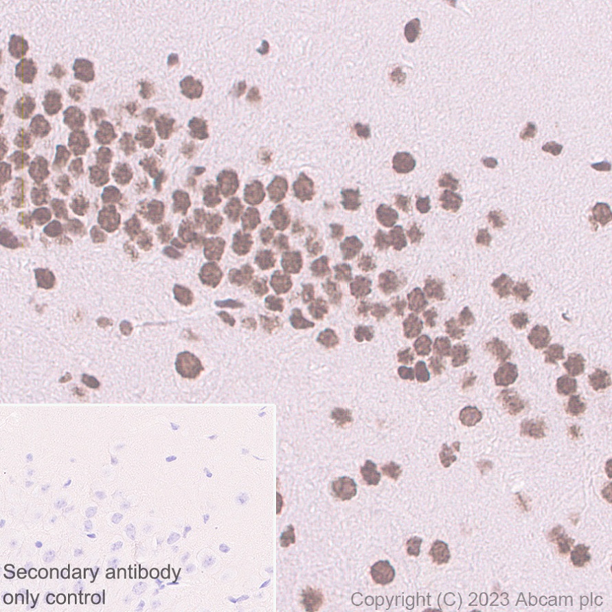 Immunohistochemistry (Formalin/PFA-fixed paraffin-embedded sections) - Anti-PHC2 antibody [EPR27147-176] - ChIP Grade - BSA and Azide free (ab314437), expandable thumbnail