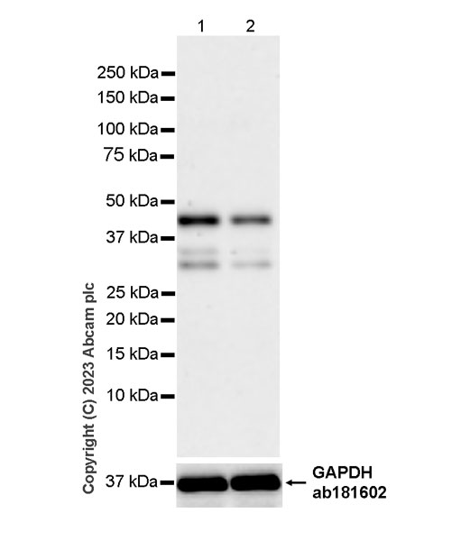 Western blot - Anti-PHC2 antibody [EPR27147-176] - ChIP Grade - BSA and Azide free (AB314437), expandable thumbnail