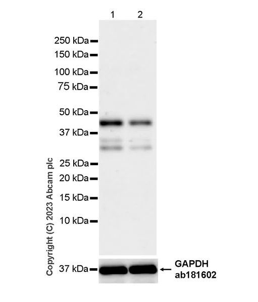Western blot - Anti-PHC2 antibody [EPR27147-176] - ChIP Grade - BSA and Azide free (AB314437)