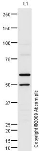 Western blot - Anti-PHD finger protein 1/PHF1 antibody (AB80042)