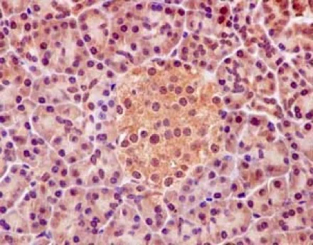 Immunohistochemistry (Formalin/PFA-fixed paraffin-embedded sections) - Anti-PHD finger protein 1/PHF1 antibody [EPR14222] (AB184951)