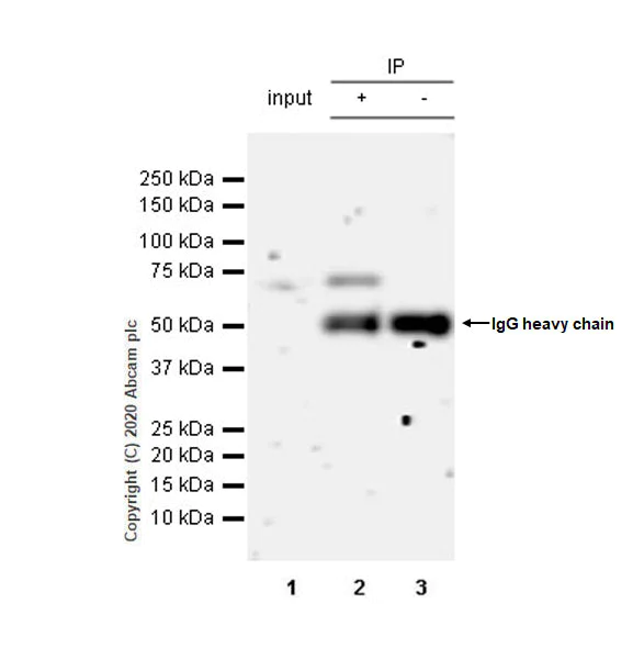 Immunoprecipitation - Anti-PHD finger protein 1/PHF1 antibody [EPR14222] (AB184951)