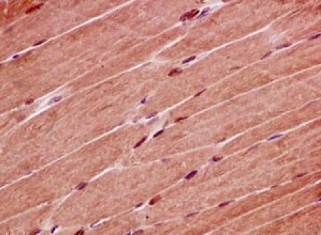 Immunohistochemistry (Formalin/PFA-fixed paraffin-embedded sections) - Anti-PHD finger protein 1/PHF1 antibody [EPR14222] - BSA and Azide free (AB232601)
