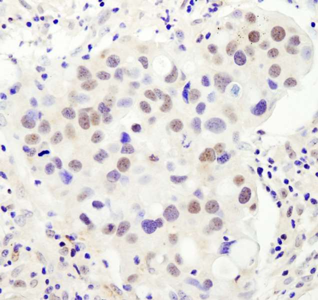 Immunohistochemistry (Formalin/PFA-fixed paraffin-embedded sections) - Anti-PHD finger protein 6/PHF6 antibody (AB264208)
