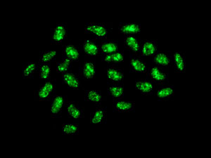 Immunocytochemistry/ Immunofluorescence - Anti-PHD finger protein 6/PHF6 antibody [EPR11996(B)] (AB170929)