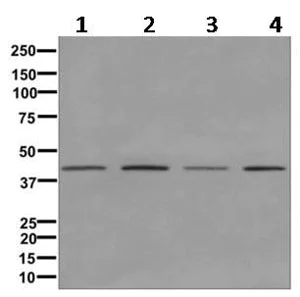 Western blot - Anti-PHD finger protein 6/PHF6 antibody [EPR11996(B)] (AB170929)
