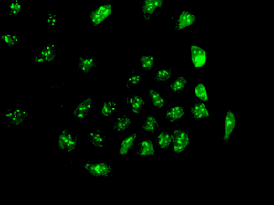 Immunocytochemistry/ Immunofluorescence - Anti-PHD finger protein 6/PHF6 antibody [EPR11997] - BSA and Azide free (AB240176)