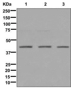 Western blot - Anti-PHD finger protein 6/PHF6 antibody [EPR11997] - BSA and Azide free (AB240176)