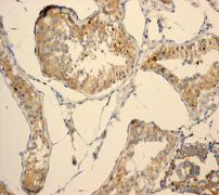 Immunohistochemistry (Formalin/PFA-fixed paraffin-embedded sections) - Anti-PHD1/prolyl hydroxylase antibody [EPR2745] (AB108980)