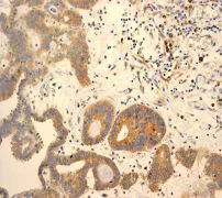 Immunohistochemistry (Formalin/PFA-fixed paraffin-embedded sections) - Anti-PHD1/prolyl hydroxylase antibody [EPR2745] (AB108980)