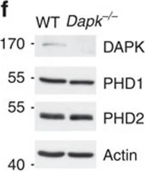 Western blot - Anti-PHD1/prolyl hydroxylase antibody [EPR2745] (AB108980)