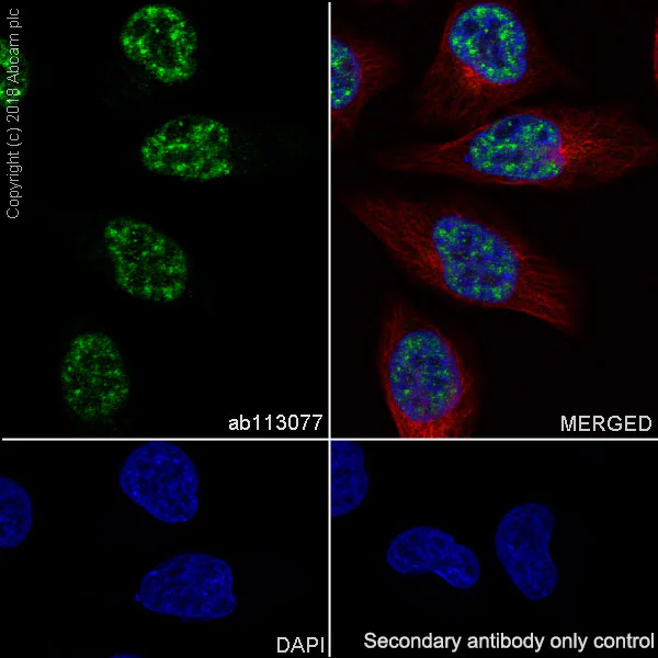 Immunocytochemistry/ Immunofluorescence - Anti-PHD1/prolyl hydroxylase antibody [EPR2746] - BSA and Azide free (AB242386)