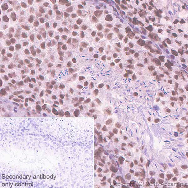 Immunohistochemistry (Formalin/PFA-fixed paraffin-embedded sections) - Anti-PHD1/prolyl hydroxylase antibody [EPR2746] - BSA and Azide free (AB242386)