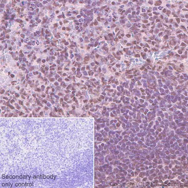 Immunohistochemistry (Formalin/PFA-fixed paraffin-embedded sections) - Anti-PHD1/prolyl hydroxylase antibody [EPR2746] - BSA and Azide free (AB242386)
